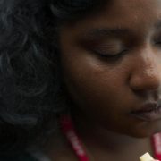 Dark Skin Bruises Differently