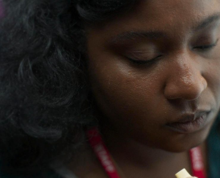 Dark Skin Bruises Differently