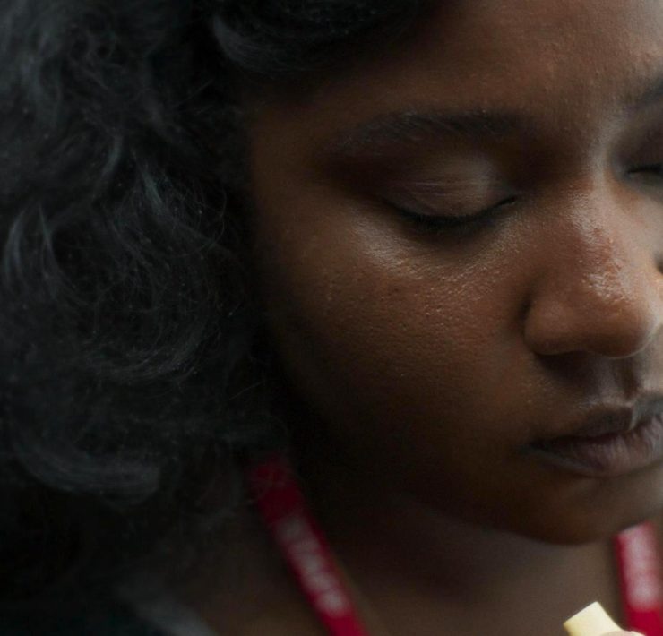 Dark Skin Bruises Differently